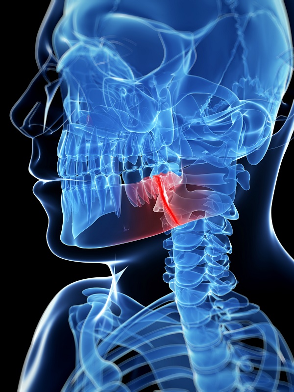 Understanding Facial Trauma Sedaros Oral Surgery