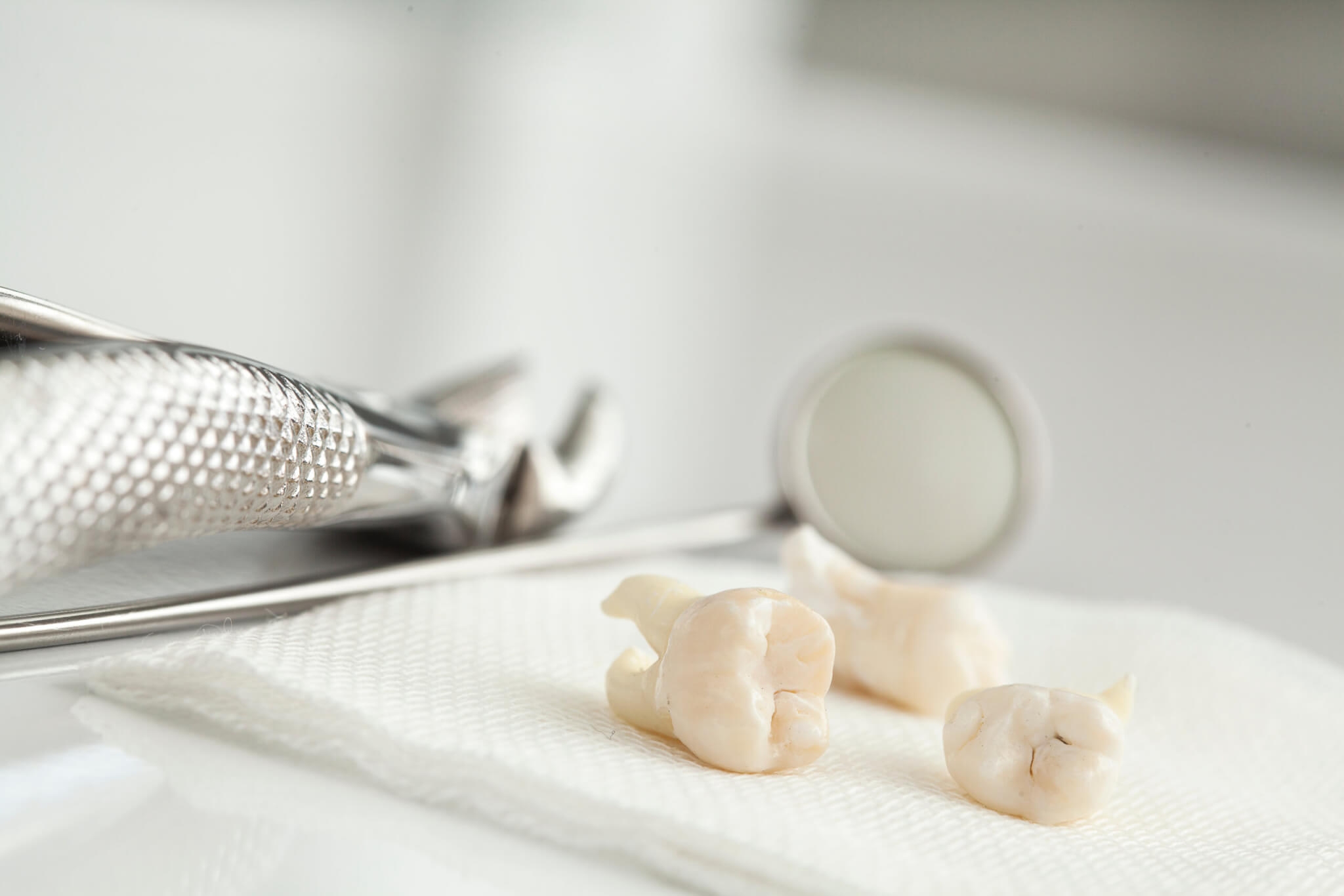 Wisdom Teeth Removal: 9 Recovery Tips and What to Avoid - Sedaros Oral ...